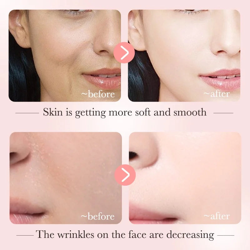 BIOAQUA Niacinamide Serum for Reducing Dark Spots Whitening and Moisturizing Brightening Skin Tone 30Ml